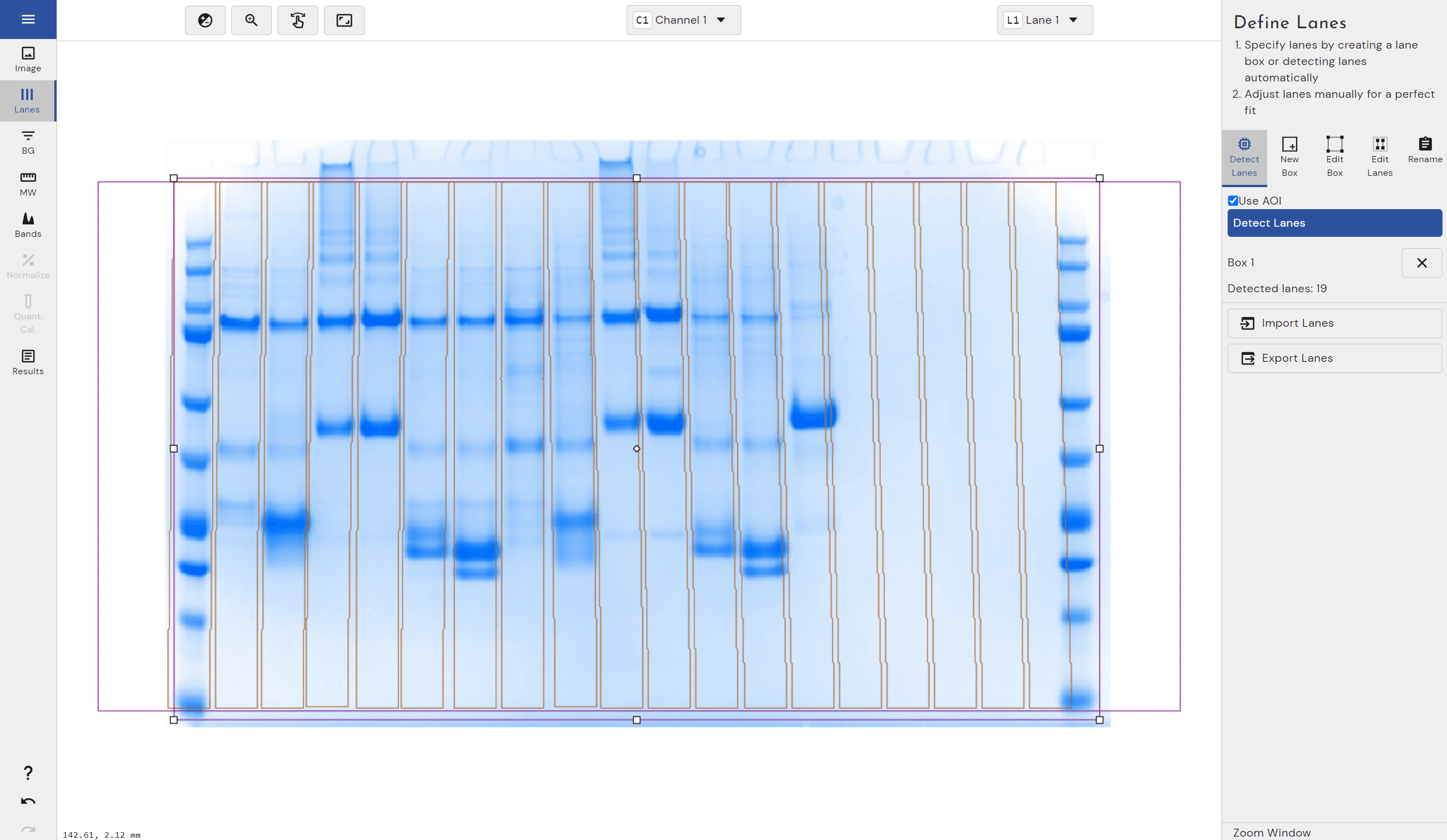 How Automatic Lane Detection Works in Phoretix 1D - TotalLab
