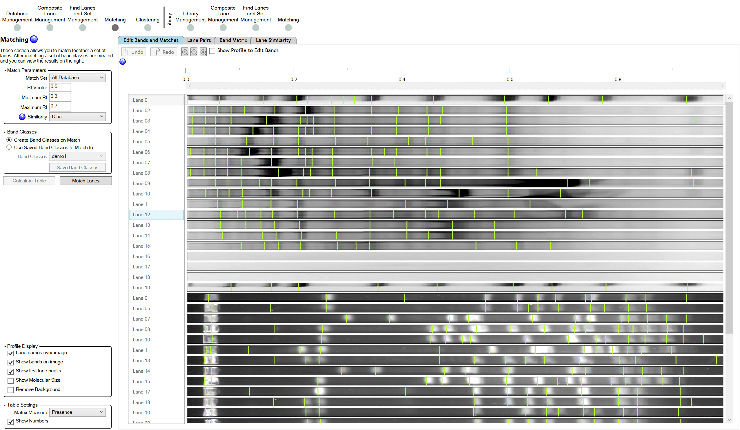 Analysis of sample lanes in 1D gel electrophoresis highlighting differences