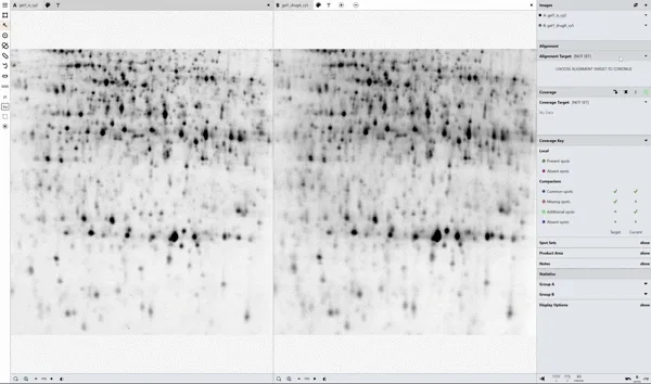 Phoretix 1D 1D SDS-PAGE Automatic Lane Detection