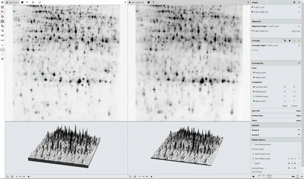 Phoretix 1D SDS-PAGE Automatic Band Detection