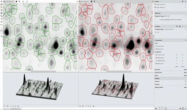 Phoretix 1D SDS-PAGE Background Subtraction