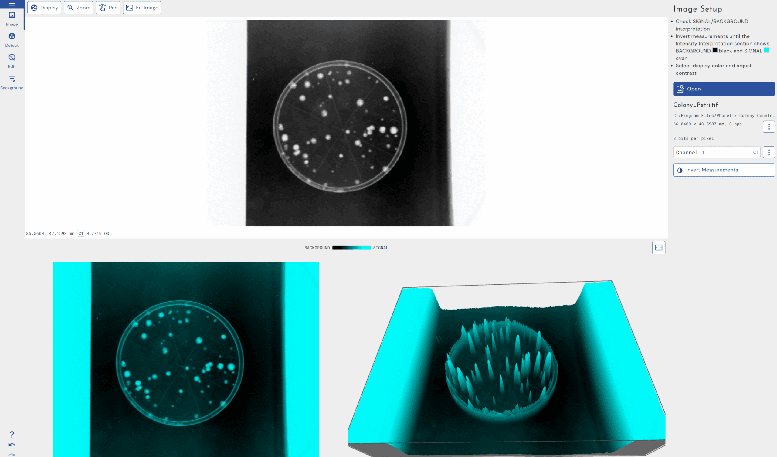 Automatic Bacterial Colony Counting Software