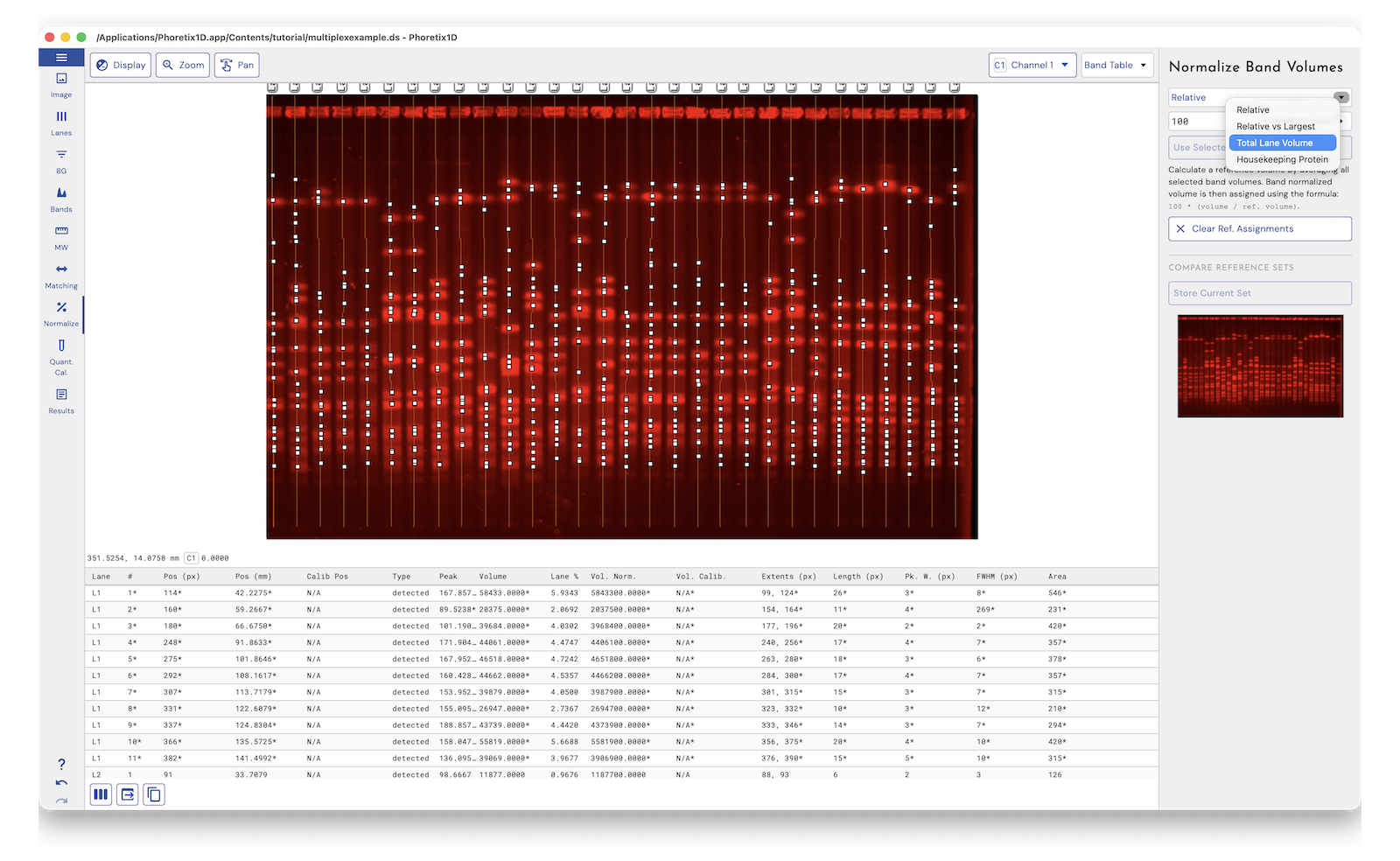 Phoretix 1D normalization panel with total protein loading control selected and normalized western blot band volumes in the results table